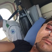 僻地トリップの恐怖!インドネシアで頭部をリーフヒットしたジェレミー・フローレス