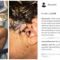 現WQSランキングトップのレオナルド・フィオラヴァンティがUSオープン開催直前に負傷