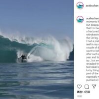 エイドリアン・バッカンが骨折でツアー離脱：代理出場は西豪のレジェンド