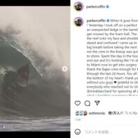 パーカー・コフィンが顔面からリーフヒットで負傷:バルバドスのスープボウル