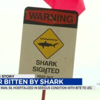 オアフ島サウスショアでシャークアタック発生:男性サーファーが噛みつかれ重体に