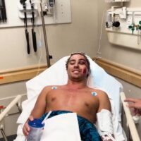 パイプラインで数十針縫う怪我を負ったコア・ロスマン!本人が一部始終を解説