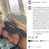 シャークアタック後のカイ・マッケンジー！ノア・ディーンやクラウドファンドなど