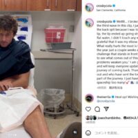 バックドアでリーフにヒット!クロスビー・コラピントが肘骨折でツアー離脱へ