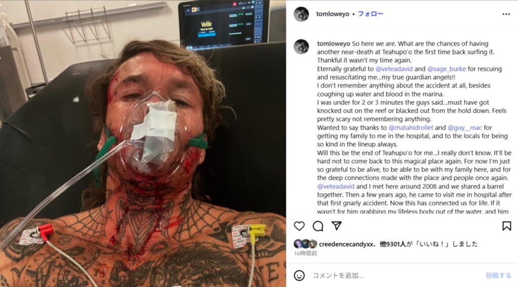 先週炸裂したチョープーでニアデス事故が発生！トム・ロウ本人によるSNS投稿