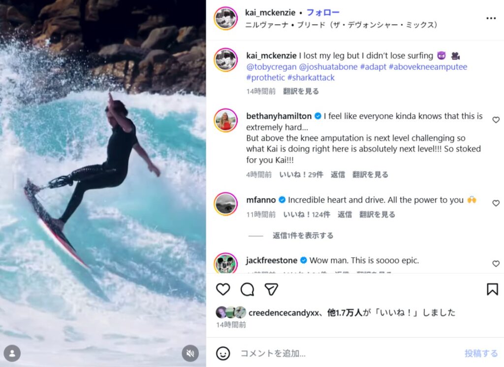 義足を使ってトップターンを決めるまでに復活したカイ・マッケンジーの現在