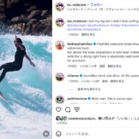 義足を使ってトップターンを決めるまでに復活したカイ・マッケンジーの現在