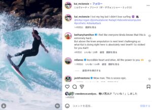 義足を使ってトップターンを決めるまでに復活したカイ・マッケンジーの現在