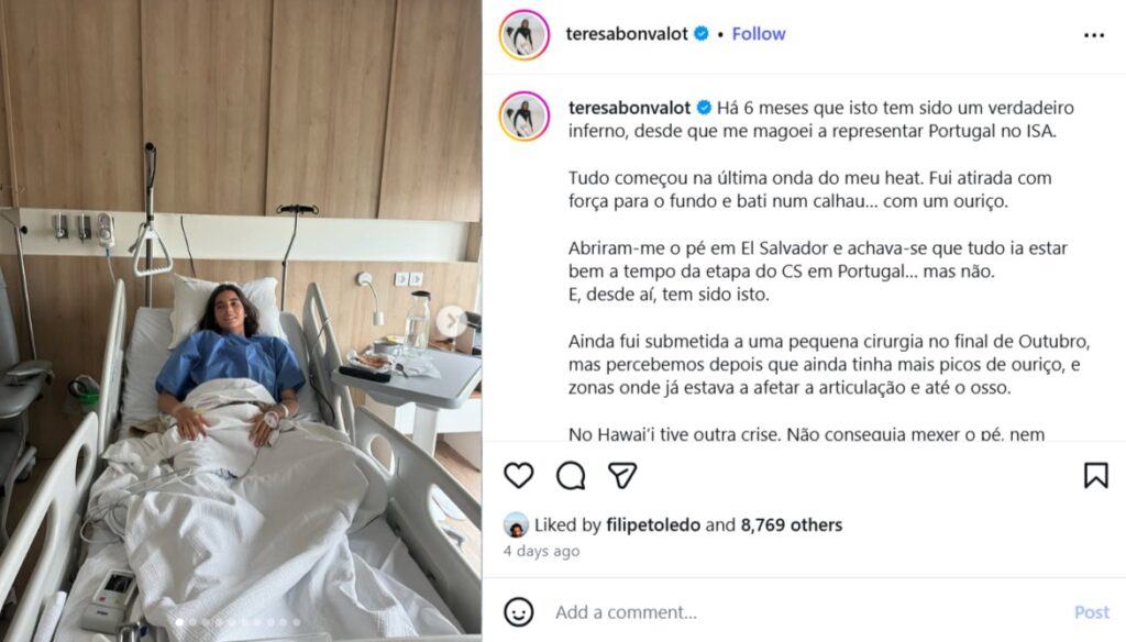 ウニの棘は想像以上に危険!テレサ・ボンヴァロトが合併症と手術をSNSで発表